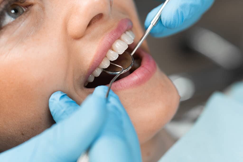 Woman having her teeth checked for cavities